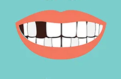 前牙缺失的原因有哪些？