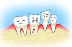 牙周病导致牙齿缺失，种植牙来修复
