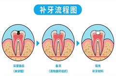 补牙三步有，健康跟我走！