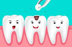 牙齿补牙材料能维持多久？