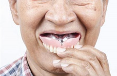 老年人镶固定义齿还是活动义齿好？