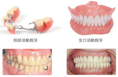 <b>活动假牙的材料有哪些？</b>