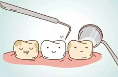 哪种方法美白牙齿最合适？冷光美白？