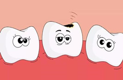 牙齿有洞是否可以做冷光美白牙齿