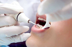 超声波洁牙会磨损牙齿吗？