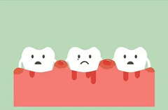 超声波洁牙能治疗牙龈炎吗？
