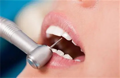 喷砂洁牙会损伤牙齿吗？