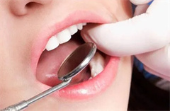什么是喷砂洁牙？喷砂洁牙后怎么护理牙齿？