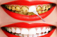 黄牙齿如何变白？