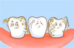 四环素牙有哪些临床表现？