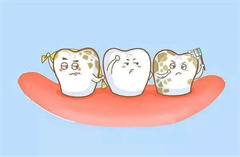 影响牙齿变色的原因有哪些？