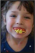遗传的色素牙怎么处理？