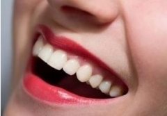 如何让牙齿变白点？