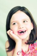 儿童缺牙后是否需要镶牙？