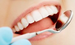 二氧化锆全瓷牙有哪些优点？