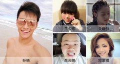 （结束）全球两大顶级奢华矫治器限时特惠！