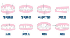 <b>咬合不正可以戴牙套吗？</b>