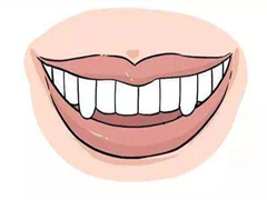 <b>长了几颗尖牙能矫正吗？</b>