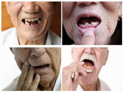 <b>八十岁老人能种植牙吗</b>