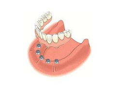 <b>牙种植满口费用是多少</b>