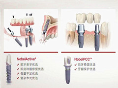<b>诺贝尔种植牙价格</b>