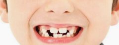 六岁半儿童可以牙齿矫正吗