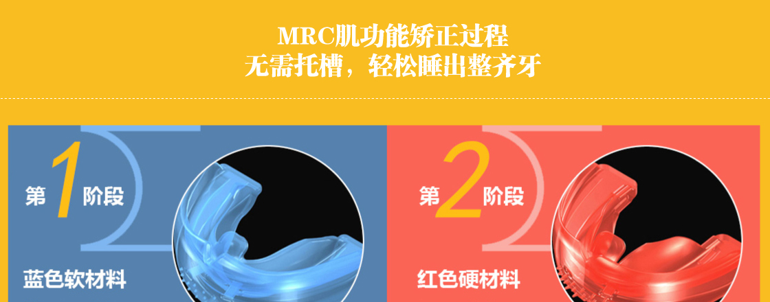 MRC肌功能矫治器 3-5岁牙齿正畸新选择